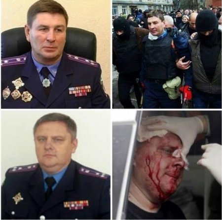 Горловские милиционеры находятся на лечении в Киеве