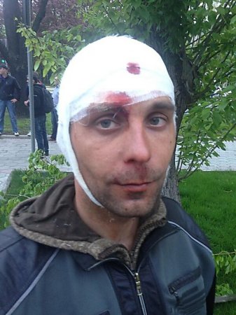 Донецкая милиция, бездействовавшая при нападении сепаратистов на мирный митинг, уверяет, что у нее все под контролем