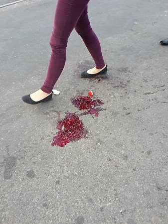 В ходе столкновений в Одессе погиб участник шествия «За единство Украины»,18+