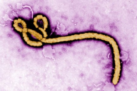Вирус Эбола и российский след