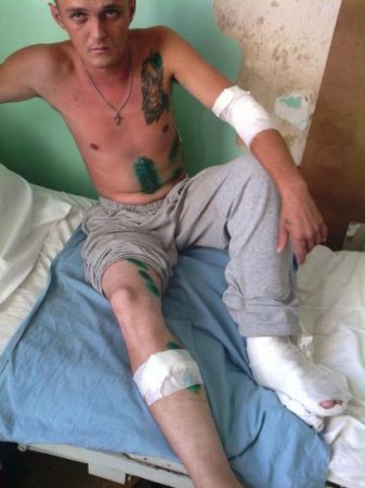 В больницы Крыма массово свозят раненых террористов (фото)