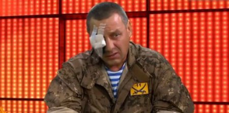 Украинский боец потерял глаз, но продолжил участие в войне как волонтер. ВИДЕО