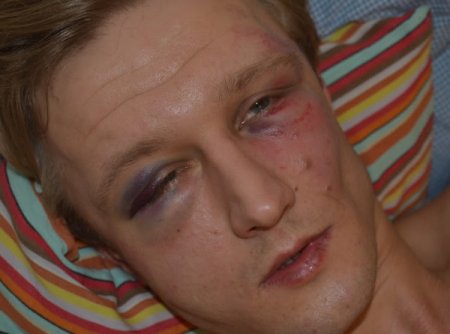 В центре Киева молодчики в камуфляже избили университетского преподавателя