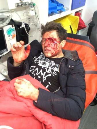 В Киеве зверски избит Андрей Джеджула (Фото) В Киеве зверски избит Андрей Джеджула (Фото)