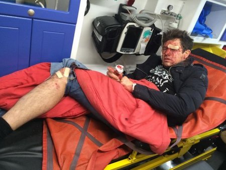 В Киеве зверски избит Андрей Джеджула (Фото) В Киеве зверски избит Андрей Джеджула (Фото)