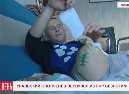 Наемник с Урала, потерявший ногу на Донбассе,не советует никому сюда ехать: «Там очень страшно» (видео) Наемник с Урала, потерявший ногу на Донбассе,не советует никому сюда ехать: «Там очень страшно» (видео)