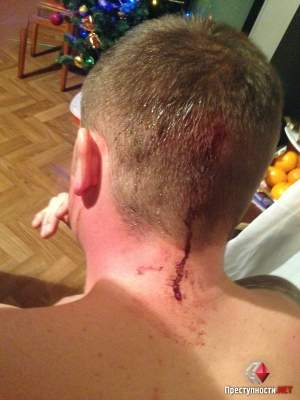 «Новогодние» разборки в Николаеве: парню выстрелили в затылок и в спину, никто не задержан