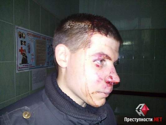Одесситы поймали одного из избивших добровольца полка «Азов» - им оказался террорист из России