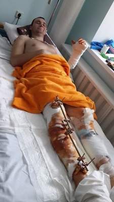Воин АТО из Очакова, получивший тяжелое ранение в бою на Донбассе, нуждается в помощи