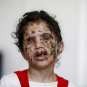 Война в Йемене: кровь и слёзы (ФОТОЛЕНТА 18+)