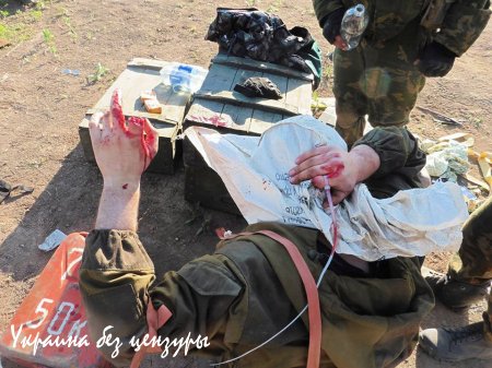 Боевик «Правого сектора» в «Фейсбуке» похвастался фотографиями пленного ополченца с отрезанными пальцами (18+)