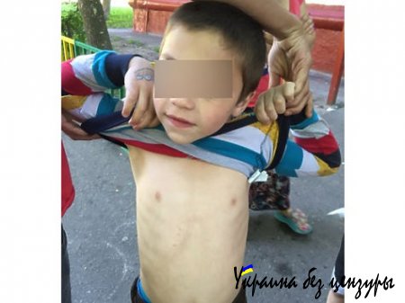 В Москве охранник супермаркета ударил ребенка электрошокером