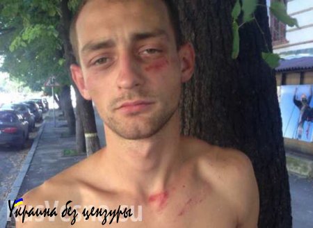 Фашисты в балаклавах похитили и избили активиста «Оппозиционного Блока» (ФОТО)