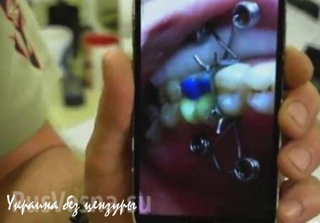 Желто-голубые пломбы: маразм украинской патриотической стоматологии (ФОТО)