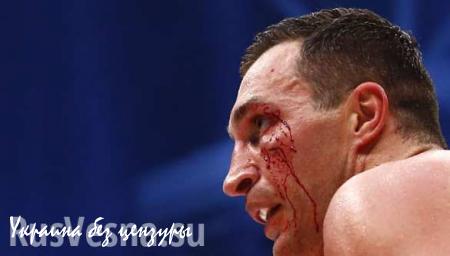 Эра Кличко закончилась — Фьюри о победе над украинским боксером (ВИДЕО)