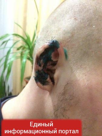 Херсонский политик откусил половину уха главе отделения Гражданского корпуса «Азов» (ФОТО)