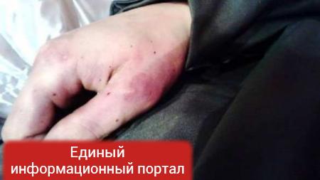 В Мариуполе жестоко убили нацгвардейца, командиры пытаются выдать это за самоубийство (ФОТО 18+)