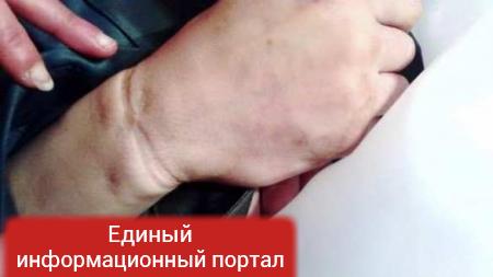 В Мариуполе жестоко убили нацгвардейца, командиры пытаются выдать это за самоубийство (ФОТО 18+)